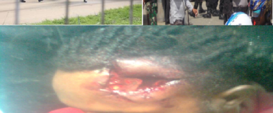 Up to 81 West Papuans arrested and many tortured for joining pro MSG rallies