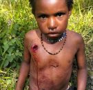 President Wenda: At least nine killed as Indonesia commits new massacre in Puncak